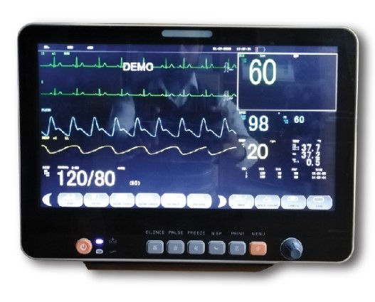 Patient observation monitor